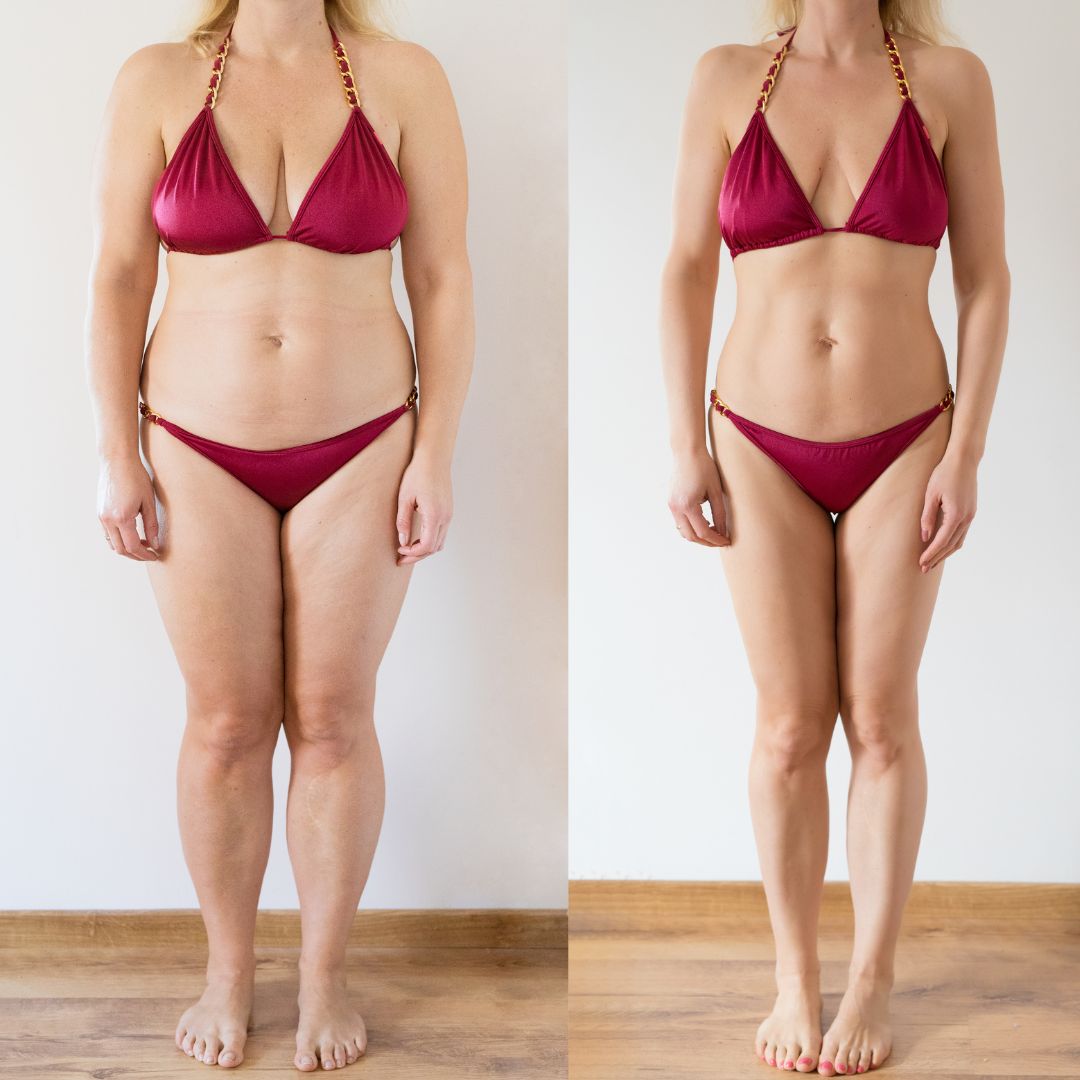 Luskine Body Pro – Massage lymphatique connecté avec IA